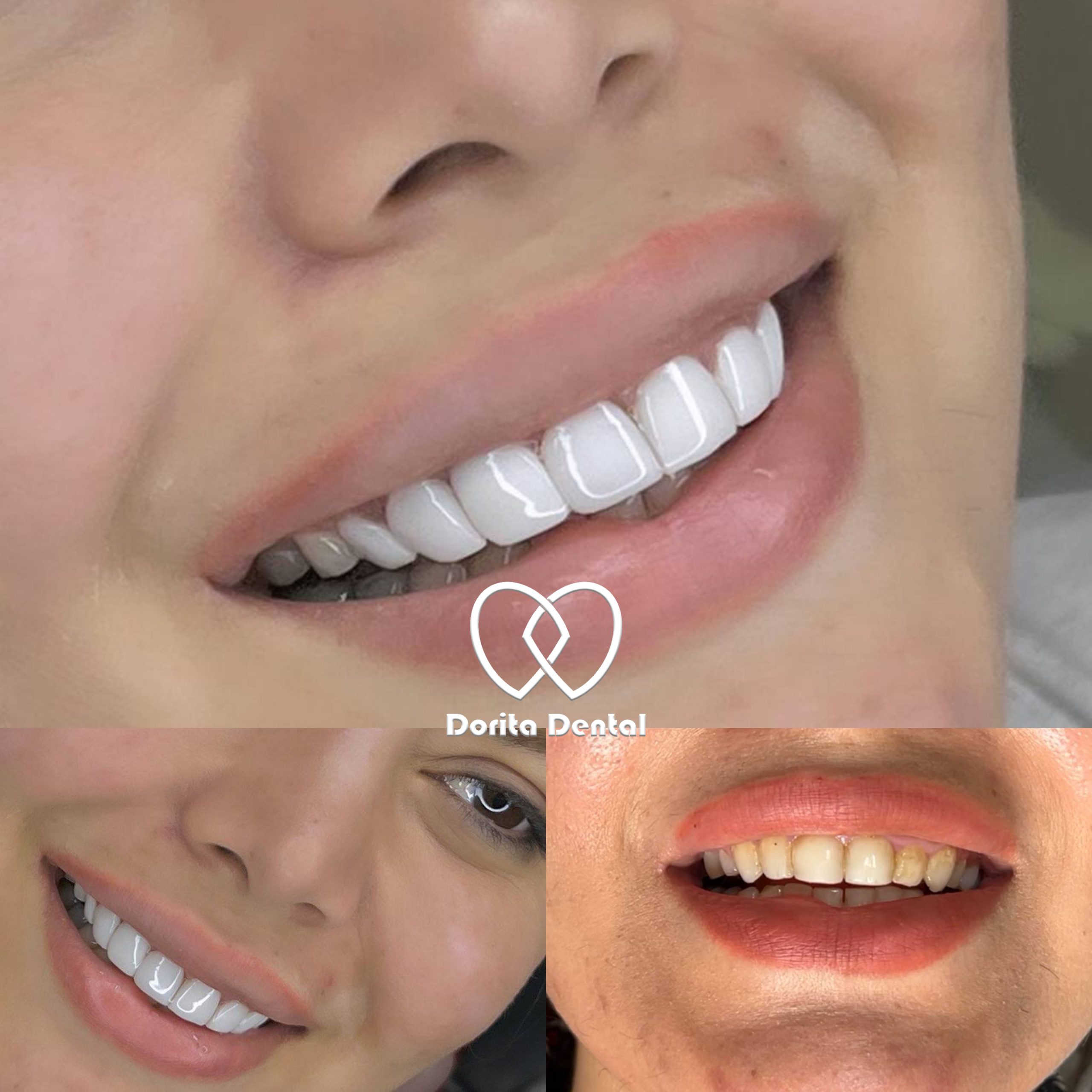 نمونه کار دندانپزشکی دریتا دنتال